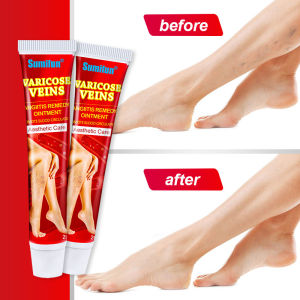Kem Suy Giãn Tĩnh Mạch tinh chất thảo dược thiên nhiên cam kết an toàn và hiệu quả