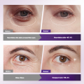 Firming Anti-wrinkle Eye Mask Multieffect Essence Eye Patch Eye Lines Remove Eye Bags Dark Circles. 