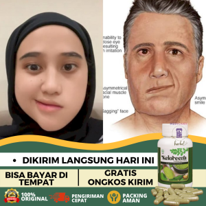 Obat Bells Palsy Obat Herbal Bells Palsy Obat Wajah Mencong Sebelah Obat Wajah Lumpuh Sebelah Obat Kelumpuhan Otot Wajah Sebelah Obat Lumpuh Separuh Wajah Obat Stroke Ringan dan Berat Dengan KELOREENA 50 KAPSUL 100% ORIGINAL HERBAL ALAMI