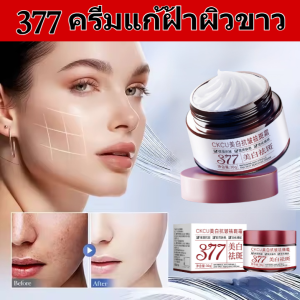 377ครีมแก้ฝ้าผิวขาว ครีมทาฝ้า ครีมไวท์เทนนิ่ Whitening freckle cream อุดมไปด้วยไนอาซินาไมด์ ยับยั้งการสร้างเมลามิน