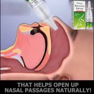 【Special Discount】South Moon 100% ORIGINAL Anti Snoring Nasal Spray Portable Anti Snoring Spray Chronic Rhinitis Sinusitis Spray Chinese Safe Traditional Herb Extractive(20ml)