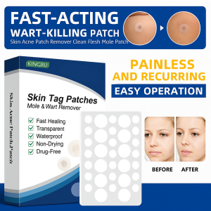 Wart Skin Tags Moles Remover Patches Wart Foot Corns Mole Acne Removal Treatment Herbal Extract Stickers Plaster Safe Painless