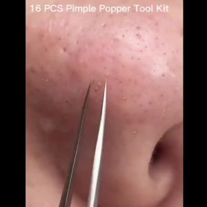 Blackhead Remover Tool 16 PCS Pimple Popper Tool Kit Tweezers Set for Eyebrows Hair Removal Pimple Blemish Acne Comedones Extractor Whitehead Cyst Removal Tool for Nose Face Beauty Tools (Golden)