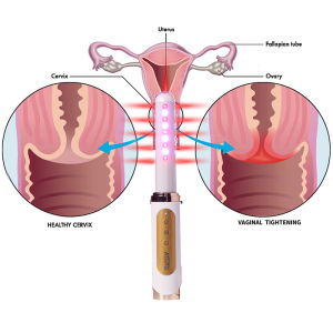 ATANG Promotion Tens Laser Device for Vagi-nal tighten and gynecological Treatment cold laser therapy Vagi-nal Vibrator best gift for women