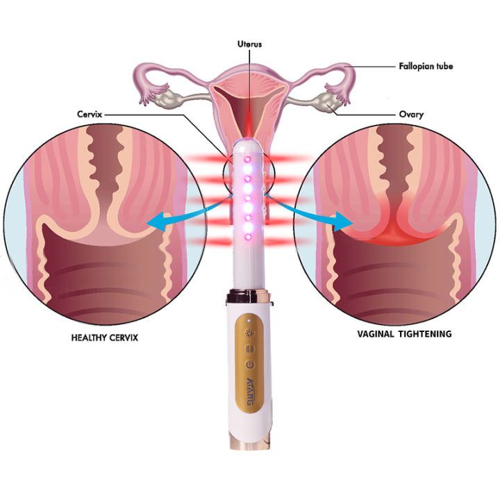 Red light therapy for Gynecological physical therapy cold laser vagi-nal tightening vagi-nitis care