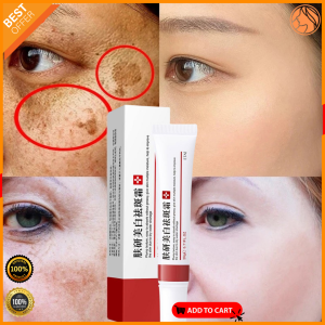 FRECKLE removal whitening cream melasma removal cream original set pekas remover serum anti melasma