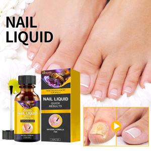 Ximonth Bee Venom Nail Care Serum Repair Damaged Nails Treatment Nail Fungus obat jamur kuku