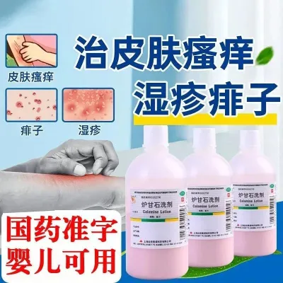 本土炉甘石洗剂100ml(儿童可用）皮肤病皮炎湿疹痱子热痱止痒荨麻疹外用药