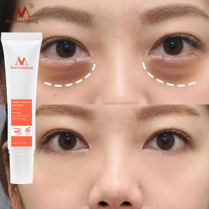 MeiYanQiong สารสกัดจากสมุนไพรครีมบํารุงรอบดวงตาต่อต้านริ้วรอยแห่งวัยกําจัดรอยคล้ําจางหายไปริ้วรอย HERBAL EXTRACTS EYE CREAM 15g