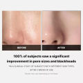 Medicube Dual-Textured Toner Pads - Gentle Exfoliation & Pore Refining 70pcs. 