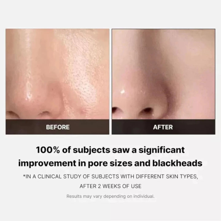 Medicube%20Dual-Textured%20Toner%20Pads%20-%20Gentle%20Exfoliation%20&%20Pore%20Refining%2070pcs%20-%20Image%203