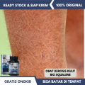 obat kulit xerosis, obat kulit kering, obat kulit bersisik, obat kulit gatal, obat kulit pecah pecah, kulit mengelupas, Kulit kering disertai dengan kemerahan - bio squalene. 