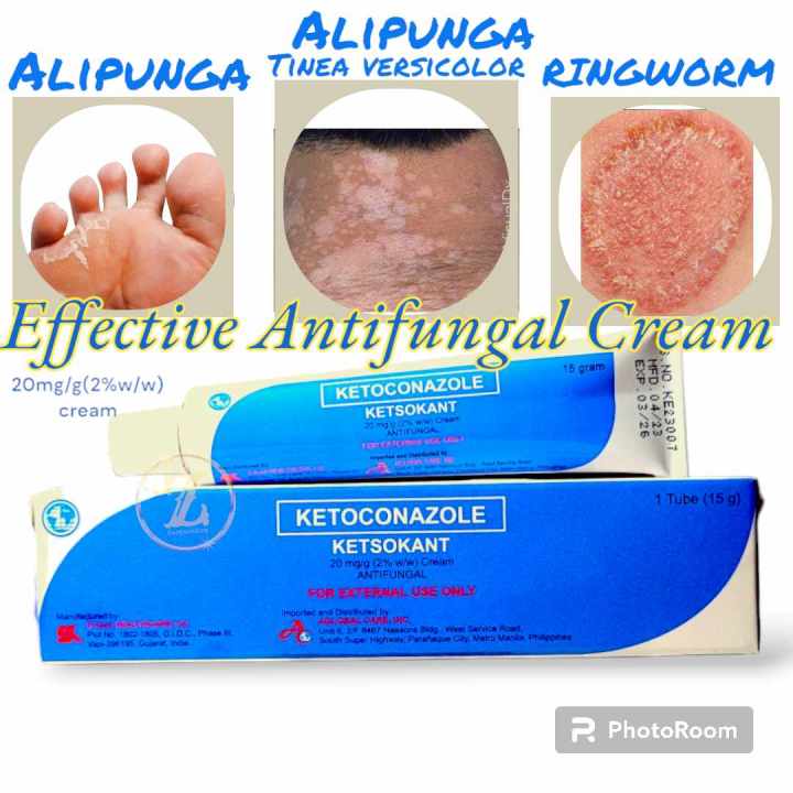 Effective AntiFungal Cream Ointment KETSOKANT Ketoconazole for Anan ...