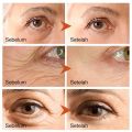 Eye cream menghilangkan mata 50g panda penghilang kantung mata eye cream untuk kantung krim mata penghilang mata panda memudar lingkaran hitam Hidrasi. 