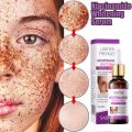 SAODER Whitening Essence Serum Remove Whiten Facial Moisturize Serum Remove Freckle Fade Dark Spot Anti-aging Whiten Facial Moisturize Serum Wajah Glowing Whitening Essence Niacinamide Skin Serum pencuci flek Removing Dark spot. 
