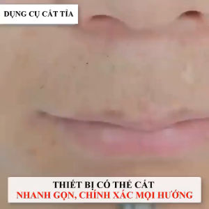 Tỉa mũi chính hãng siêu việt cắt nhanh ngọt bền và rất chất lượng