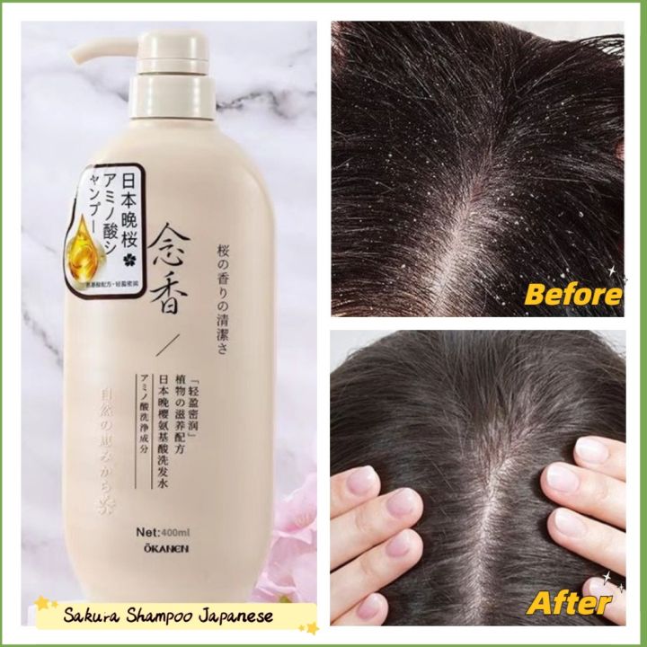 Sakura Shampoo Japanese 400ml Japan Moisturizing Dandruff removal