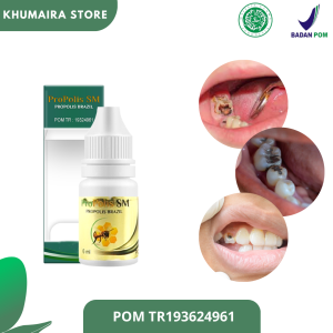 Obat Sakit Gigi Karena Berlubang Penghilang sakit Gusi Bengkak Linu Ngilu Gusi berdarah Obat Gusi Bengkak Nyut Nyutan - Propolis Sm Asli Original  TerMurah