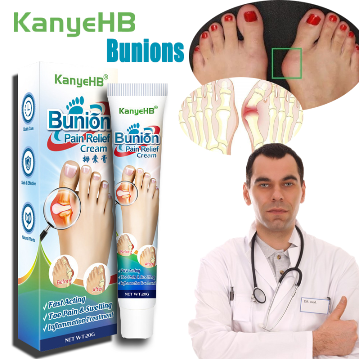 Kanyehb Bunions Split Pain Relief Cream Soothing Elbow Tendon Ointment 