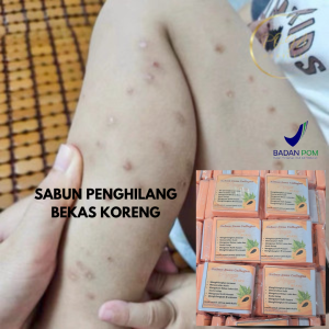 Sabun Collagen Pencerah Kulit & Penghilang Bekas Luka - Paket Tunggal BPOM Orii untuk Kulit Kombinasi/Sensitif