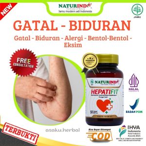 Obat Gatal Biduran Alergi Eksim Kering Basah Bentol Kaligata Gatal Berair Hepatifit Herbal Naturindo