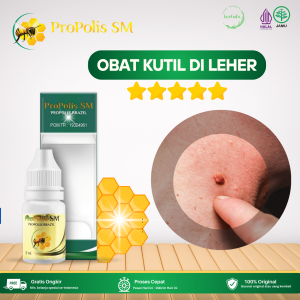 Obat Kutil Di Leher Obat Kutil Papiloma Di Leher Obat Penghilang Skin Tag Obat Perontok Kutil Papiloma Obat Penghilang Kutil Di Leher Obat Penghilang Kutil Dan Papiloma Obat Merontokan Kutil Dengan Propolis SM