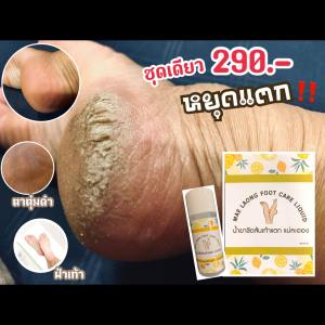 แก้ส้นเท้าแตกทันที น้ำยาขัดพร้อมฟองน้ำขัด