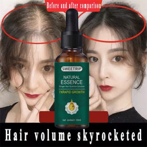 SWEETRIP Penumbuh Rambut Cepat Dan Tebal Serum Penumbuh Rambut 30ml Penumbuh Rambut Botak Pria Menyehatkan Kulit Kepala&Meningkatkan Regenerasi Rambut Penumbuh Rambut Botak Paling Cepat Original 100% [Versi Berkualitas Tinggi]