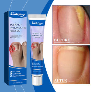 South Moon Toe Nail Paronychia Relief Ointment Nail Fungus Care Ointment nourishes moisturizes and softens the nail surface gently cleanses the hands feet nail care (20g)