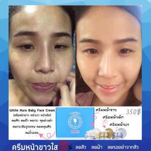 White Aura Baby Face Cream ครีมทาหน้า ครีมหน้าขาวใส หน้าเงา สิว ฝ้า ก็ระ จุดด่างดำ รอยดำ รอยแดง ริ้วรอย หน้าขาว หน้าใส
