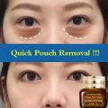 Eye Cream mata untuk Mengurangi Dark Circle Anti-Wrinkle Anti-agging Remover Eye terhadap Puffiness Dan Bags Cream Penghilang Mata Panda - Pencerah Kantung Mata - Krim Kantung Mata - Mata Panda Keriput - Krim Pemutih Kantung Mata-krim mata pencerah. 