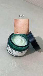 Kem Dưỡng Da Some By Mi Dưỡng Ẩm Phục Hồi Giảm Mụn Chiết Xuất Ốc Sên Tràm Trà AHA-BHA-PHA 30 Days hộp 60g