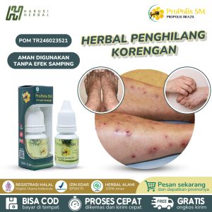 Obat Koreng Cenang Bernanah Gatal Budug Di Tangan Kaki Koreng Di Kaki Dan Tangan Koreng Menahun Bekas Luka Dengan Propolis SM