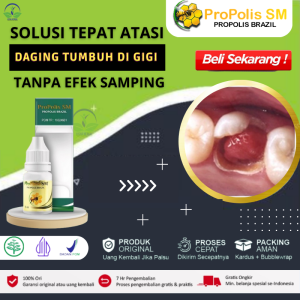 Obat Tradisional Gigi Berlubang Tumbuh Daging Penghilang Daging Tumbuh Dalem Gigi Agar Bisa Sembuh Obat Untuk Daging Tumbuh Di Sekitar Gigi Berlubang Polip Pulpa di Gigi Tumbuh Daging Dalam Gusi Bengkak & Bernanah Herbal Propolis SM Original ASLI