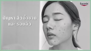 Eucerin Pro ACNE SOLUTION ANTI-ACNE MARK 40ML Facial serum reduces dark spots and helps reduce acne.