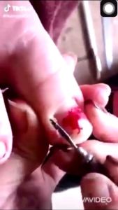 [HCM]Cây lấy khóe ngọt lịm (bao phê)