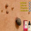 Skin Tag Remover Penghilang Kutil Tanpa Luka Serum Perbaikan Flek Hitam Memudarkan Flek Memutihkan Tanpa Bekas 20ml. 