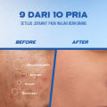 [TRIPLE PACK] FYNE Face Wash Pria Acne Care + Oil Clear 100ml. 