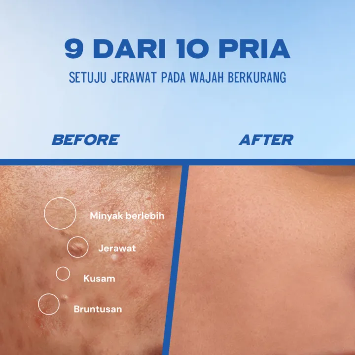 %5BTRIPLE%20PACK%5D%20FYNE%20Face%20Wash%20Pria%20Acne%20Care%20+%20Oil%20Clear%20100ml%20-%20Image%204