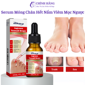 Serum Loại Bỏ nấm móng Móng Chân Mọc Ngược Làm Mềm Trắng Móng Và Giảm Đau Đồng Thời Phòng Ngừa Viêm Và Khử Trùng 10ml