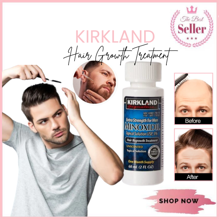 [authentic]kirkland Signature Minoxidil 5 Extra Strength Hair Regrowth