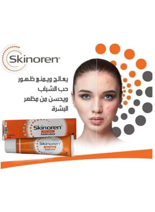 Skinoren%20%E0%B8%84%E0%B8%A3%E0%B8%B5%E0%B8%A1%E0%B8%97%E0%B8%B2%E0%B8%AA%E0%B8%B4%E0%B8%A7%2030g%20%E0%B8%A3%E0%B8%B1%E0%B8%81%E0%B8%A9%E0%B8%B2%E0%B8%97%E0%B8%B1%E0%B9%89%E0%B8%87%E0%B8%AA%E0%B8%B4%E0%B8%A7%20%E0%B8%9D%E0%B9%89%E0%B8%B2%20%E0%B8%81%E0%B8%A3%E0%B8%B0%20%E0%B9%81%E0%B8%A5%E0%B8%B0%E0%B8%A3%E0%B8%AD%E0%B8%A2%E0%B8%94%E0%B8%B3%E0%B8%88%E0%B8%B2%E0%B8%81%E0%B8%AA%E0%B8%B4%E0%B8%A7%20%E0%B9%80%E0%B8%99%E0%B8%B7%E0%B9%89%E0%B8%AD%E0%B8%84%E0%B8%A3%E0%B8%B5%E0%B8%A1%E0%B9%80%E0%B8%81%E0%B8%A5%E0%B8%B5%E0%B9%88%E0%B8%A2%E0%B8%87%E0%B9%88%E0%B8%B2%E0%B8%A2%20%E0%B8%8B%E0%B8%B6%E0%B8%A1%E0%B9%84%E0%B8%A7%20%E0%B9%84%E0%B8%A1%E0%B9%88%E0%B9%80%E0%B8%AB%E0%B8%99%E0%B8%B5%E0%B8%A2%E0%B8%A7%E0%B9%80%E0%B8%AB%E0%B8%99%E0%B8%AD%E0%B8%B0%E0%B8%AB%E0%B8%99%E0%B8%B0%20%E0%B8%A5%E0%B8%94%E0%B9%80%E0%B8%A5%E0%B8%B7%E0%B8%AD%E0%B8%99%E0%B8%88%E0%B8%B8%E0%B8%94%E0%B8%94%E0%B9%88%E0%B8%B2%E0%B8%87%E0%B8%94%E0%B8%B3%20%E0%B8%9C%E0%B8%B4%E0%B8%A7%E0%B8%AA%E0%B8%A7%E0%B9%88%E0%B8%B2%E0%B8%87%E0%B9%83%E0%B8%AA%E0%B8%82%E0%B8%B6%E0%B9%89%E0%B8%99%20%E0%B9%80%E0%B8%AB%E0%B9%87%E0%B8%99%E0%B8%9C%E0%B8%A5%E0%B8%8A%E0%B8%B1%E0%B8%94%E0%B9%80%E0%B8%88%E0%B8%99%20-%20Image%205