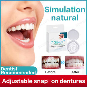 Adjustable snap-on denturesSnapon Smile Teeth Whitening Kit Temporary Tooth Kit [In stock/Limited stock/Shipping within 24 hours]
