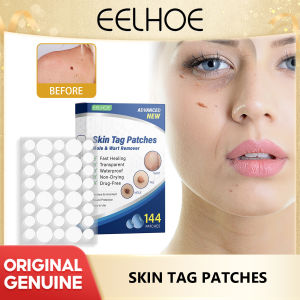 Eelhoe Wart Patch Wart Patch Chicken Eye Flesh Prick Wart Wart Flat Plantar Flesh Granulation Pointed Wart Filamentous  Wart Patch Skin Tag Removal Rubber Band Mole Wart Removal Accessories Micro Band Rubber Bands Non Toxic Health Beauty Skin Care Tools