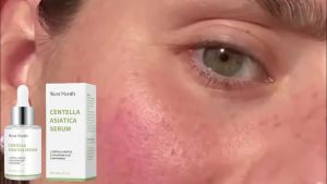 West Month :Centella Asiatica Repair Serum with Glycerin & Carbomer Even Skin Tone Hydrating Boost Skin Elasticity & Resilience