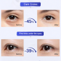 Anti-Wrinkle Eye Cream Anti-Aging Eye Serum Remove Dark Circles Eye Bags Eye Care Lotion Fades Wrinkles. 