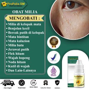 Obat Oles Milia Di Wajah ( Produk Bergaransi Resmi ) Obat Penghilang Milia Bruntusan Benjolan Jerawat Putih Obat Bopeng Flek Hitam Bintik Hitam Kutil Noda Hitam Di Wajah Milia Di Kelopak Mata Milia Batu Milia Pada Bayi - Propolis SM