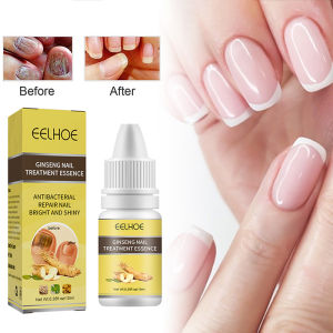 🔥Orfila Nail Repair Essence Antibacterial Nail Treatment Essential Oil Improve Grey Nail Repair Liquid Serum Fungal Nail Treatment Hand Foot Infection Care 10ml