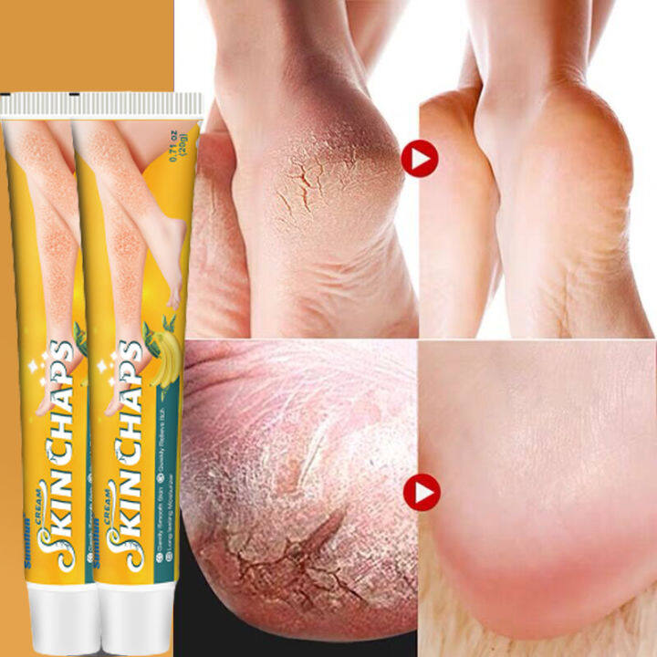 Feet cream to remove dead clearance skin