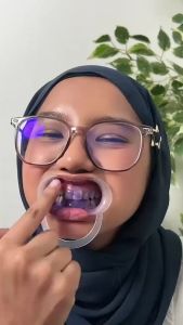Scoban Purple Toothpaste Ubat Gigi Pemutih 50g Anti-cavity Fresh Breath Stains Removal Probiotics Oral Care